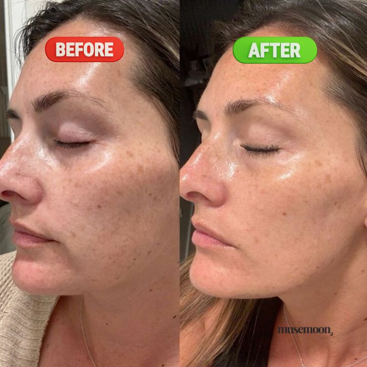 GlowSculpt - Neck and face massager and shaper - MUSEMOON GLOW